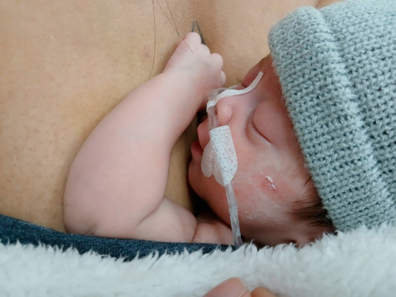 Foto bebé prematuro