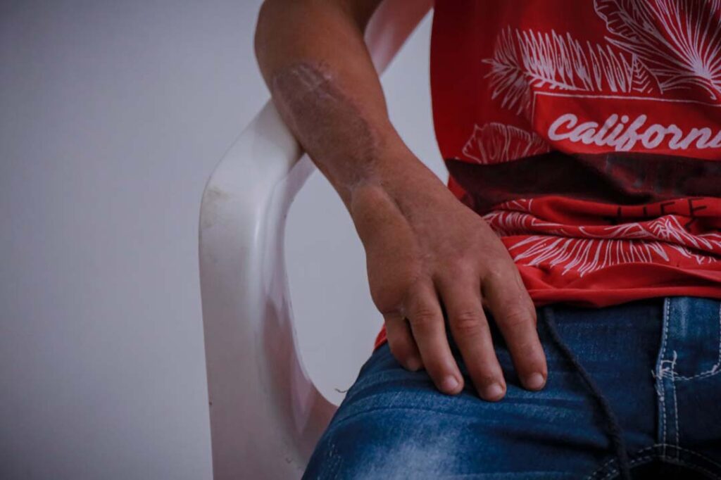 Imagen de la mano de Jhon