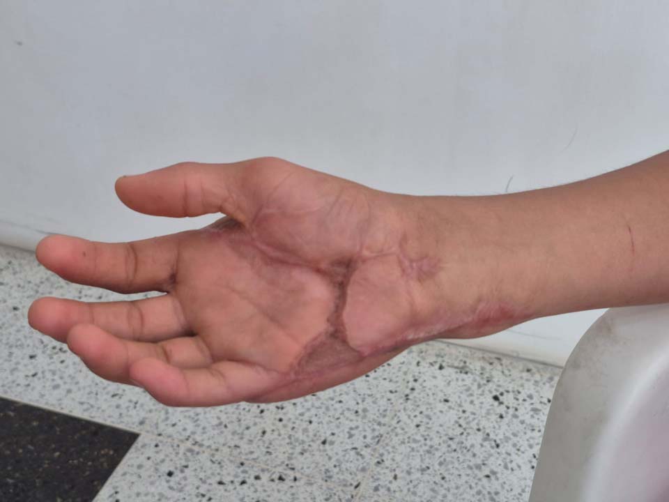 Imagen en primer plano de la mano de Jhon