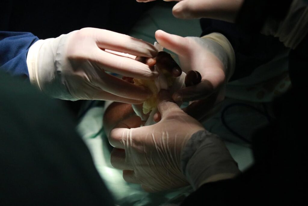 Manos a la Obra: cirugías de mano gratuitas para niños