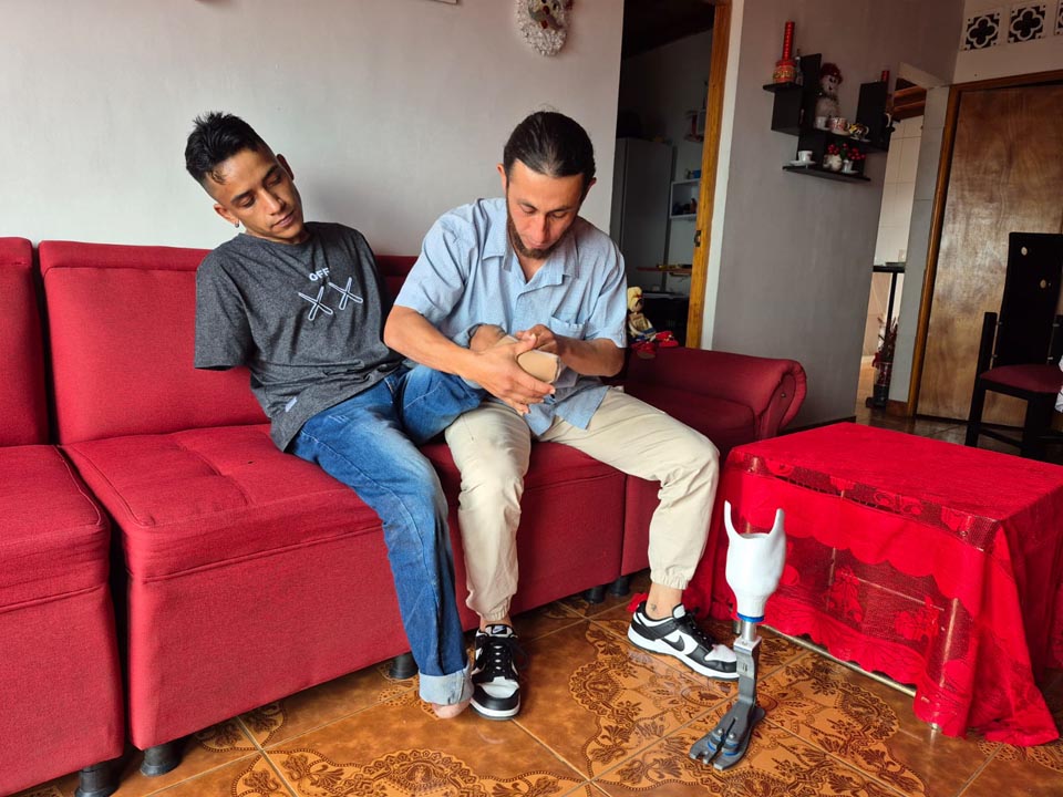 Imagen prótesis creada en Medellín por egresados del ITM LINER