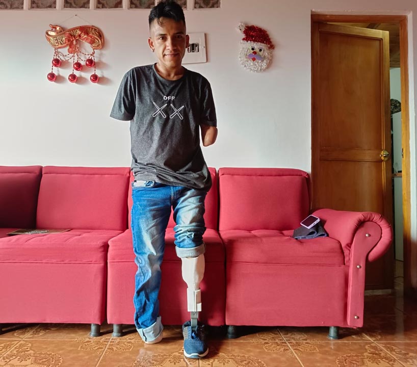 Imagen prótesis creada en Medellín por egresados del ITM TENIS